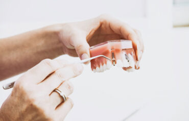 Implantes